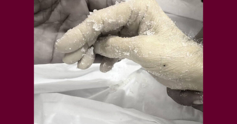 মৃত্যুর সময়েও তাসবীহ পাঠ করছিল যে হাত
